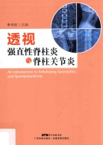 透视强直性脊柱炎与脊柱关节炎