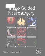 Image-guided neurosurgery