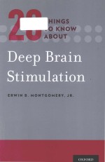 20 things to know about deep brain stimulation