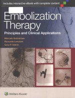 Embolization therapy principles and clinical applications