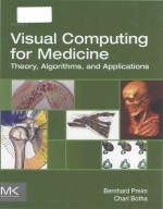 Visual computing for medicine theory