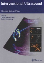 Interventional ultrasound a practical guide and atlas