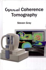 Optical coherence tomography