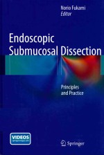 Endoscopic Submucosal Dissection