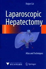 Laparoscopic Hepatectomy