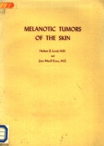 MELANOTIC TUMORS OF THE SKIN