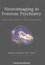 Neuroimaging in Forensic Psychiatry