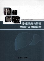 慢性肝病与肝癌MSCT及MRI诊断