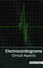 ELECTORCARDIOGRAMS:CLINICAL ASPECTS