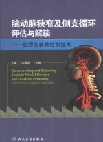 脑动脉狭窄及侧支循环评估与解读  经颅多普勒检测技术