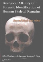 Biological Affinity in Forensic Identification of Human Skeletal Remains