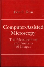 COMPUTER-ASSISTED MICROSCOPY  THE MEASUREMENT AND ANALYSIS OF IMAGES