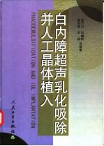 白内障超声乳化吸除并人工晶体植入