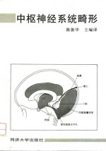 中枢神经系统畸形