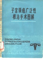 子宫颈癌广泛性根治手术图解