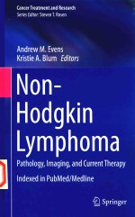 NON-HODGKIN LYMPHOMA