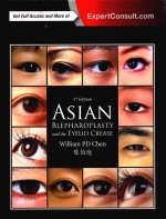 ASIAN BLEPHAROPLASTY AND THE EYELID CREASE