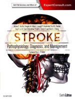 STROKE PATHOPHYSIOIOGY