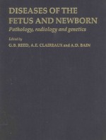 DISEASES OF THE FETUS AND NEWBORN