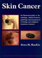 SKIN CANCER