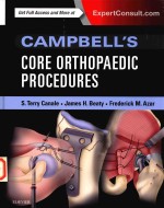 CAMPBELL'S CORE ORTHOPAEDIC PROCEDURES