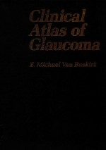 CLINICAL ATLAS OF GLAUCOMA