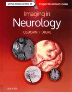 IMAGINGIN NEUROIGY