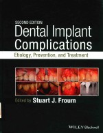 SECOND EDITION DENTAI IMPIANT COMPLICATIONS ETIOIOGY