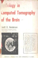 PATHOLOGY IN COMPUTED TOMOGRAPHY OF THE BRAIN