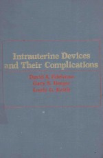 INTRAUTERINE DEVICES AND THEIR COMPLICATIONS