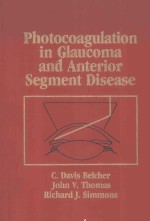 PHOTOCOAGULATION IN GLAUCOMA AND ANTERIOR SEGMENT DISEASE