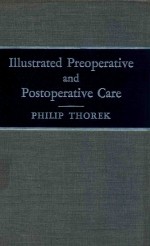 ILLUSTRATED PREOPERATIVE AND POSTOPERATIVE CARE