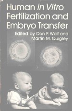 HUMAN IN VITRO FERTILIZATION AND EMBRYO TRANSFER