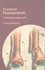 FRACTURE MANAGEMENT A PRACTICAL APPROACH