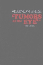 TUMORS OF THE EYE THIRD EDITION