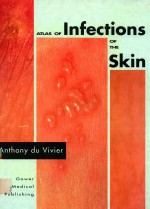 ATLAS OF INFECTIONS OF THE SKIN