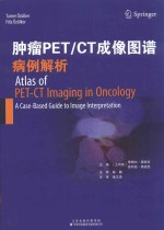 肿瘤PET/CT成像图谱  病例解析