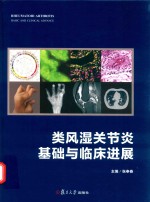 类风湿关节炎  基础与临床进展