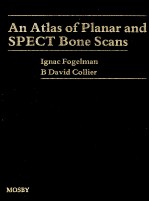 AN ATLAS OF PLANAR AND SPECT BONE SCANS