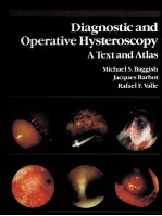 DIAGNOSTIC AND OPERATIVE HYSTEROSCOPY: A TEXT AND ATLAS