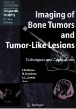 IMAGING OF BONE TUMORS AND TUMOR-LIKE LESIONS TECHNIQUES AND APPLICATIONS