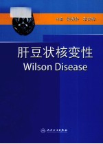 肝豆状核变性  Wilson 病