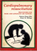 Cardiopulmonary Resuscitation