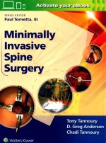 Minimally invasive spine surgery