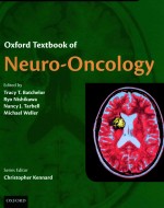 OXFORD TEXTBOOK OF NEURO-ONCOLOGY