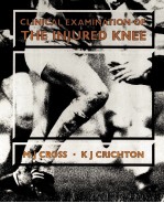 CLINICAL EXAMINATION OF THE INJURED KNEE