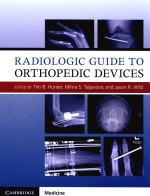 RADIOLOGIC GUIDE TO ORTHOPEDIC DEVICES