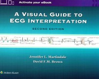 A VISUAL GUIDE TO ECG INTERPRETATION SECOND EDITION