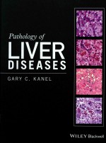 PATHOLOGY OF LIVER DISEASES