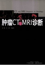 肿瘤CT与MRI诊断